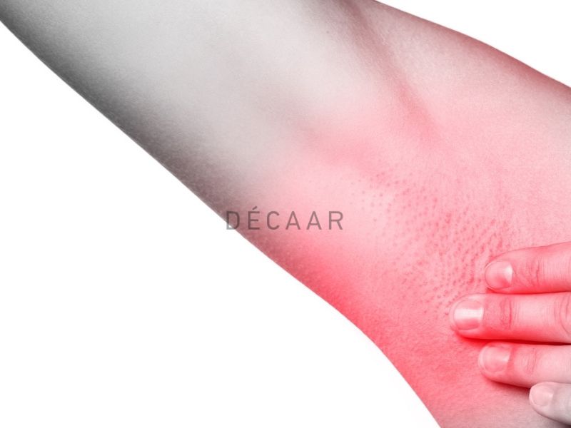 Tác dụng phụ peel nách